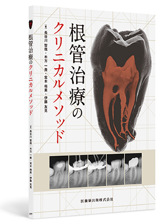 根管治療のクリニカルメソッド