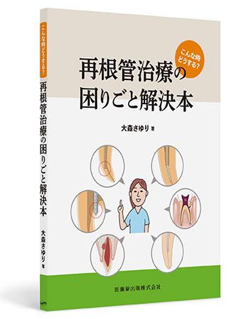こんな時どうする？再根管治療の困りごと解決本